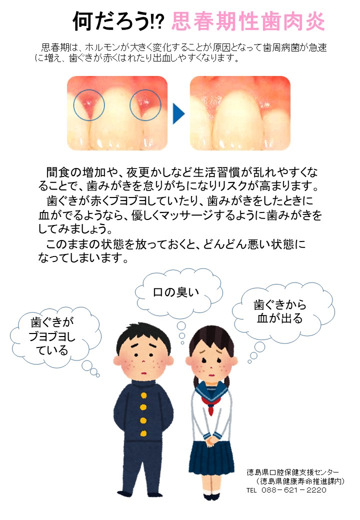 思春期性歯肉炎