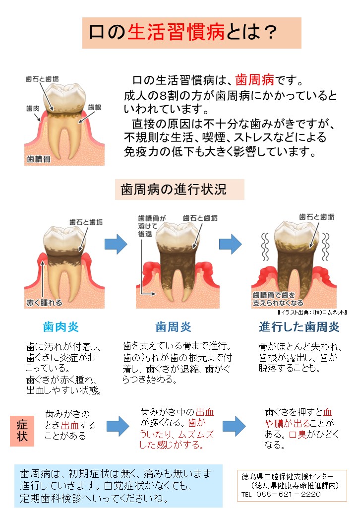 口の生活習慣病とは？